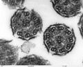 Bronchiolar Area Cilia Cross-sections