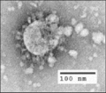 SARS-CoV-1