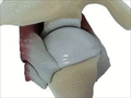 Shoulder muscle - force couple of rotator cuff