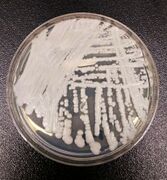 A strain of Candida auris cultured in a petri dish at a CDC laboratory.