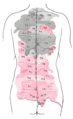 Spinal nerve