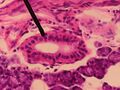 Striated duct in the parotid gland