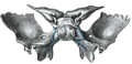 Sphenoid bone