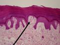 Meissner's corpuscle