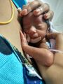Neonatal intensive care unit