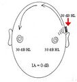 Bone conduction hearing test