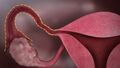 Unlabelled image showing the right Fallopian tube