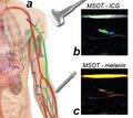 Multispectral optoacoustic tomography