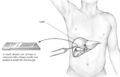 Human liver biopsy sample