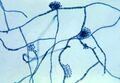 Hortaea werneckii fungus, causes tinea nigra