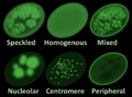 Main antinuclear antibody patterns on immunofluorescence
