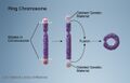 NLM ring chromosome