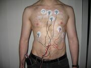 Holter monitor