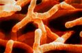 Actinomyces israelii under a microscope