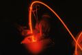 Photodynamic therapy in action