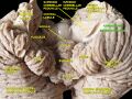 Flocculus