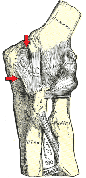 Ulnar collateral ligament of elbow joint