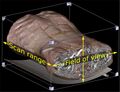Abdominal CT with scan range and field of view