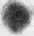 Mumps virus, negative stained TEM