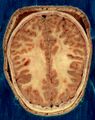 Visible Human head slice