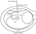 Anterior sampling technique