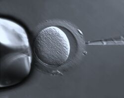Oocyte with Zona pellucida