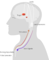 Adaptive Deep Brain Stimulation