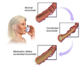 Bronchodilators