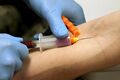 Vacutainer