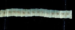 Proglottids of Diphyllobothrium latum