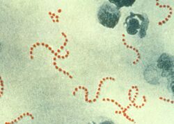 A photomicrograph of Streptococcus pyogenes bacteria, 900x Mag.