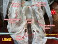 Epiglottic cartilage
