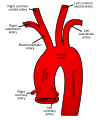 Ascending_aorta