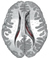 Thumbnail for version as of 17:28, 18 May 2026