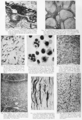 Rare diseases