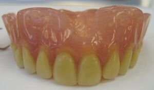 Maxillary Complete Denture