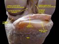 Posterior cruciate ligament