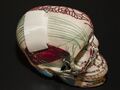 3-D Printed Skull Plate