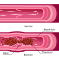 Health effects of wine