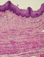 Vaginal epithelium