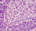 Pancreatic polypeptide cells