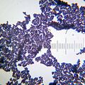 Staphylococcus bacteria culture