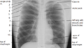 Thorax