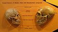 Comparison of Homo sapiens and Neanderthal skulls