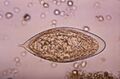 Schistosoma haematobium egg