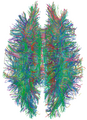 Magnetic resonance imaging