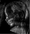 Profile of an embryo at 14 weeks