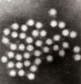 Sapovirus