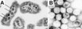 Electron micrograph of carboxysomes