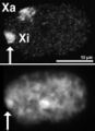 X-inactivation in a biological context